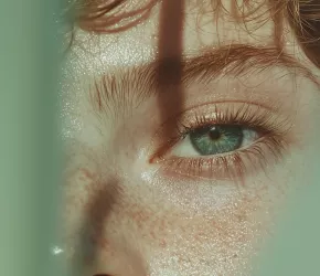 Eye Wrinkles