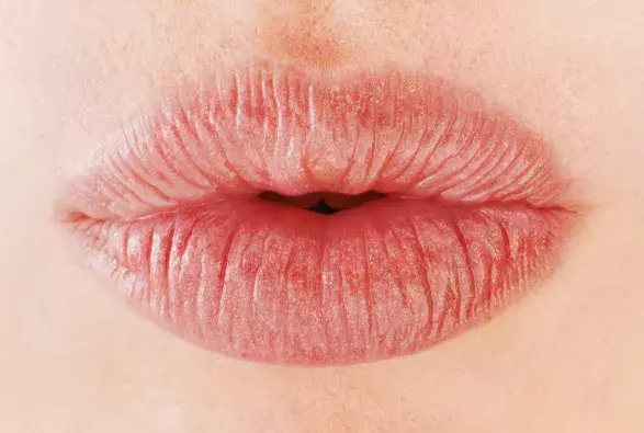 KDO CHCE (VĚTŠÍ) PUSU?