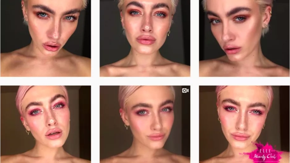 Brow lifting