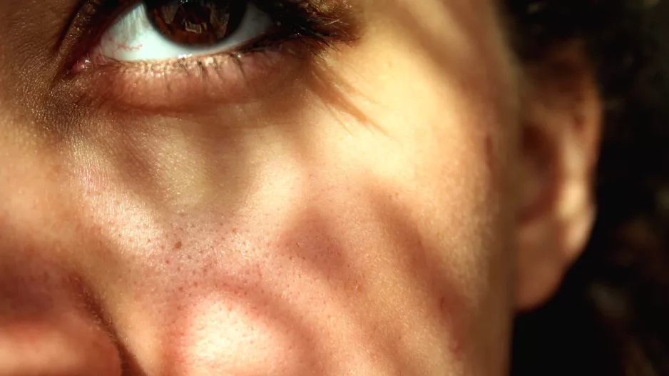 skin