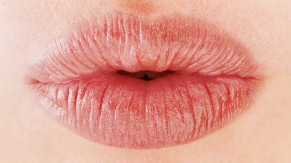 KDO CHCE (VĚTŠÍ) PUSU?