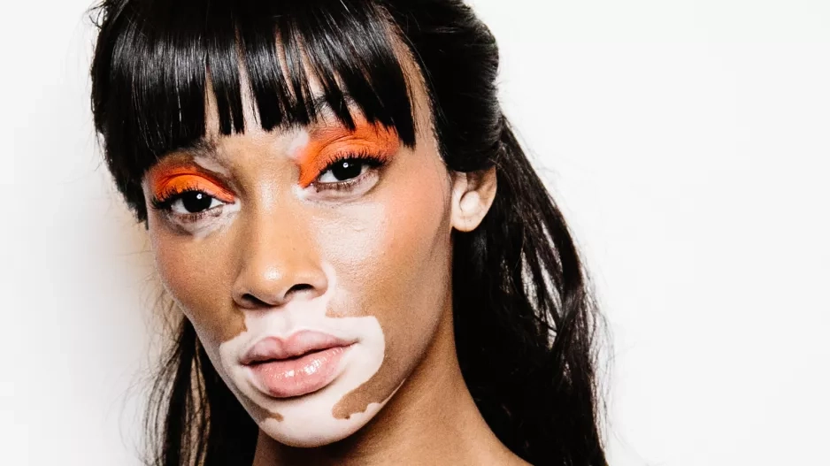 Winnie Harlow