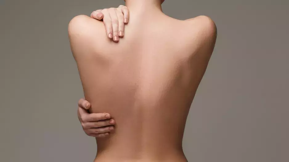 Back acne