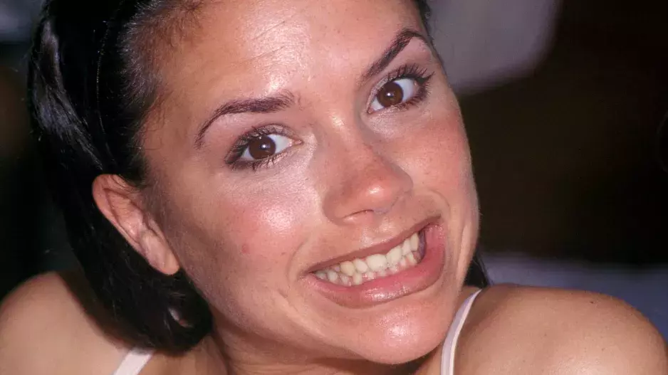 Proměny úsměvů celebrit