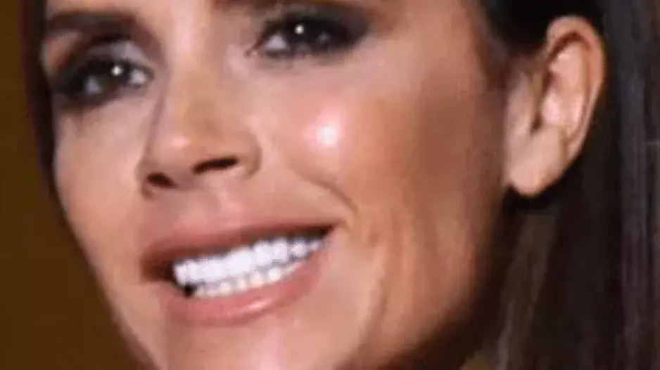 Proměny úsměvů celebrit