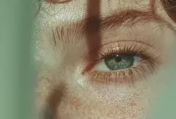 Eye Wrinkles