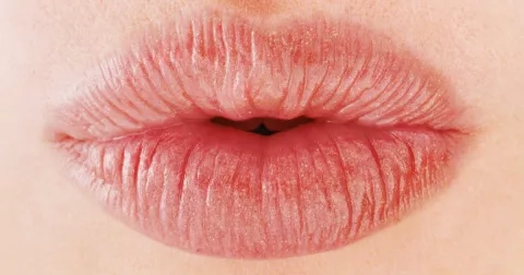 Kdo chce (větší) pusu?