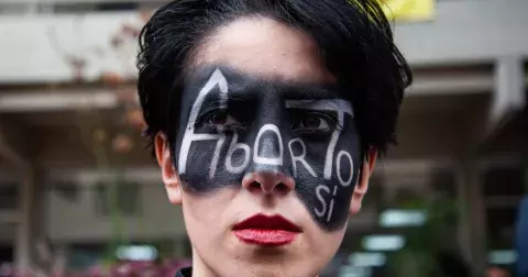 Právo na potrat ve 21. století? V celé Evropě samozřejmostí není