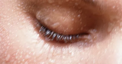 TikTok radí: Slaná voda jako všelék na akné! Ale funguje to opravdu?