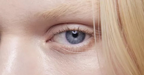 Pravidla péče o oční okolí: pryč s otoky, kruhy pod očima i vráskami