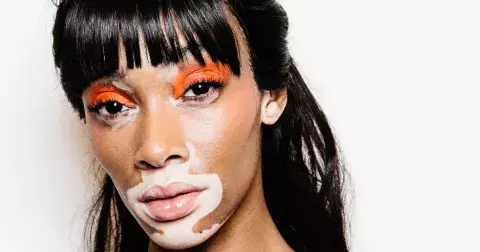 Handicapu navzdory: celebrity, které se proslavily i přes odlišnost