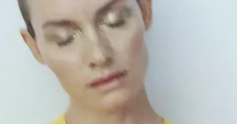 Baby botox: zákrok, který dokonale vypne pleť a nepřipraví o mimiku