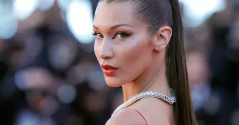 Bella Hadid chce zpět svůj nos. Proč hvězdy litují, že šly na plastiku