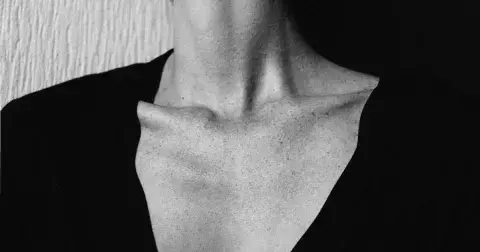 Proč rozproudit lymfatický systém: Pomůže s otoky, únavou i přibíráním