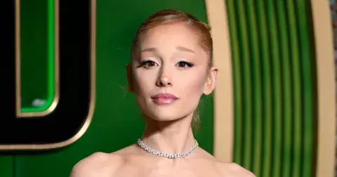 Celebrity pod skalpelem: 15 hvězd, které se doznaly k plastikám