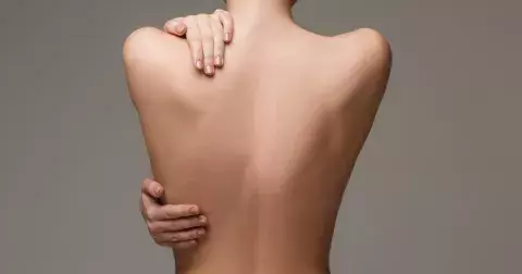 Back acne: Pupínky na zádech trápí většinu populace. Jak je přemoci?
