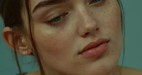 Kyselina tranexamová: Co umí a 6 nejlepších sér na sjednocení pleti