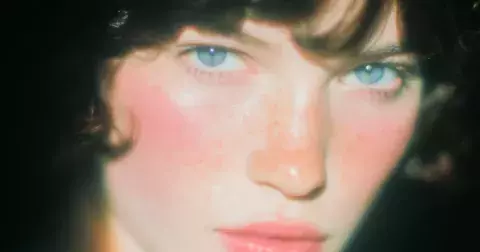 Rosacea, nebo trend? Kodaňský look vzbudil internetovou bouři
