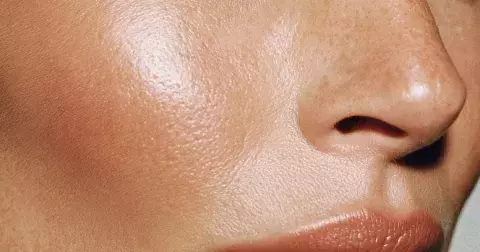 Glass skin na povel: Jak na dvojkombo tretinoinu a kyseliny azelaové